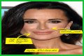Botox, Implants & More! – Hollywood Life